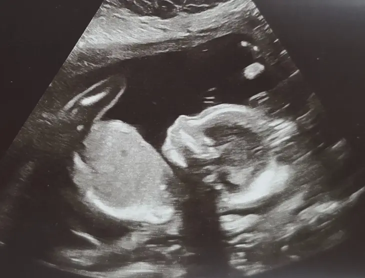 Baby Regalado