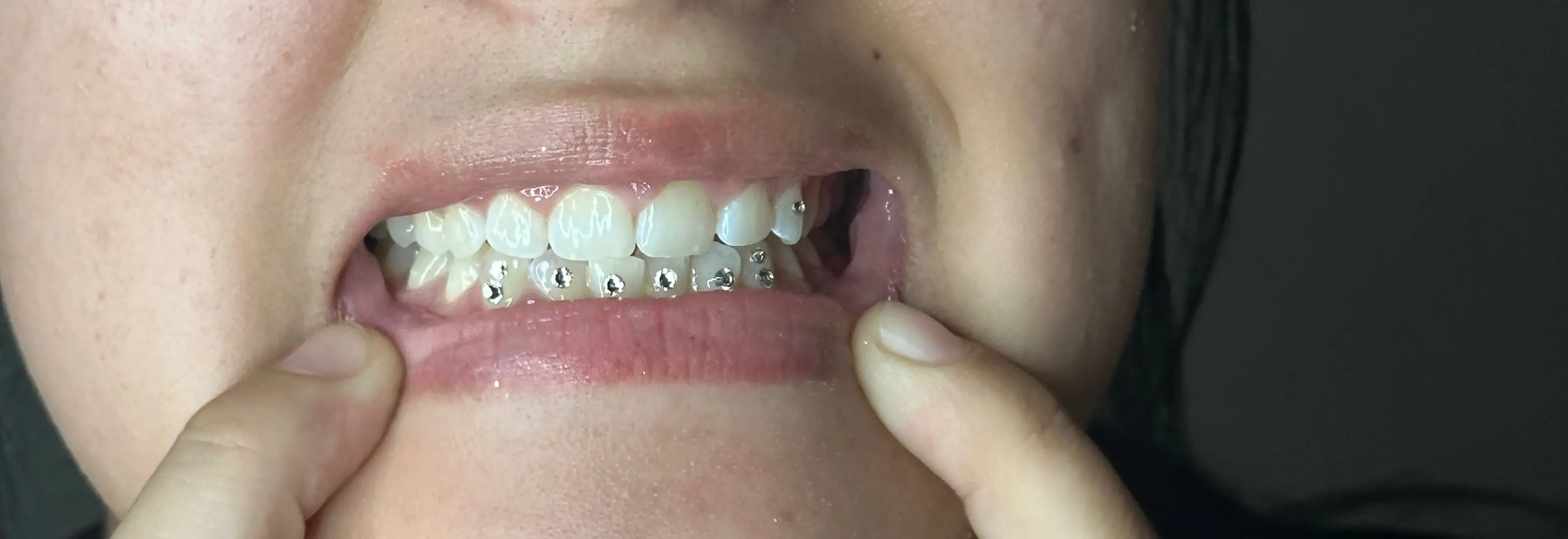 Billing out your teeth. boost ur confidence