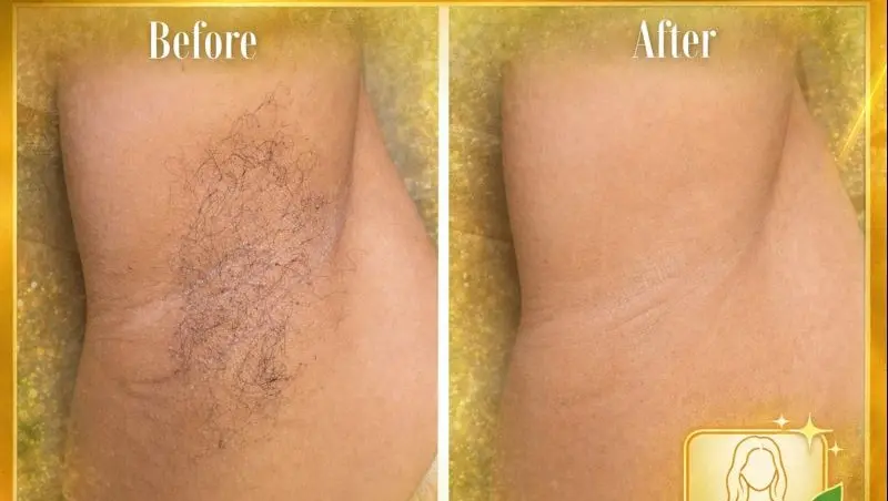 Sugaring Hair Removal. Under Arm